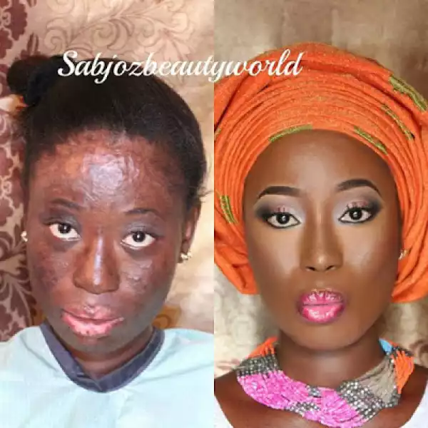 Amazing Photo : See How a Makeup Artist Transformed Gas Explosion Survivor